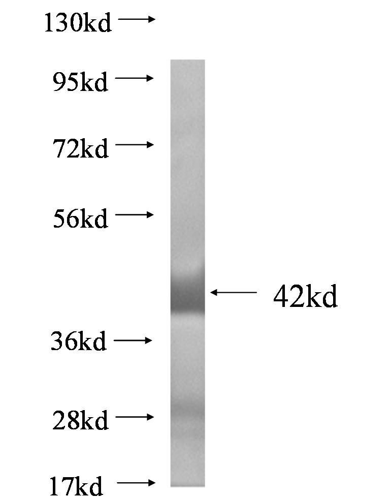 RPS19 fusion protein Ag0828 SDS-PAGE