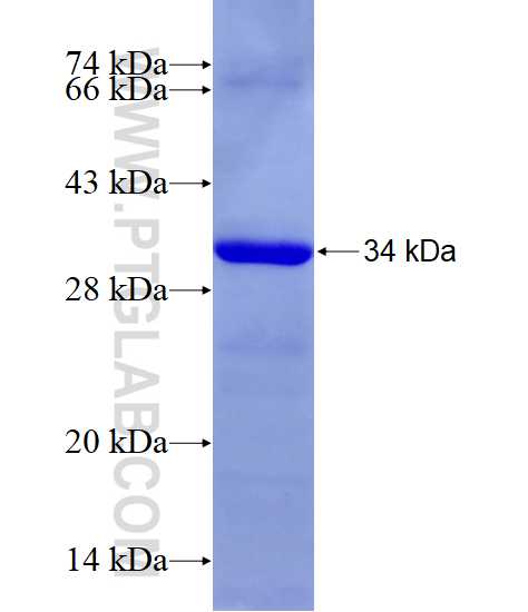 RPS2 fusion protein Ag28322 SDS-PAGE