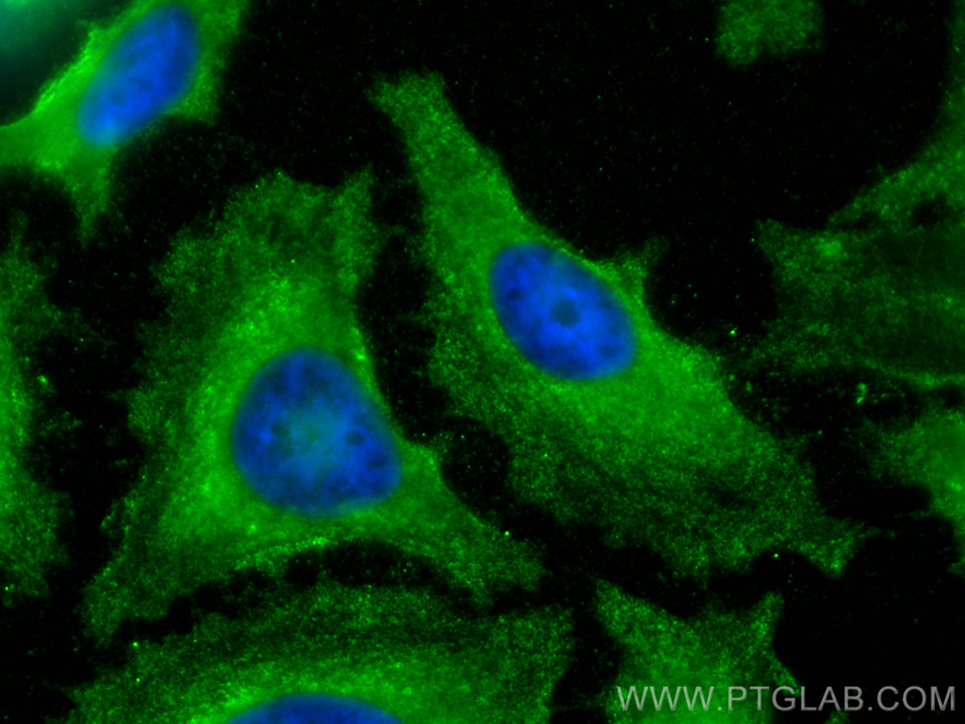 IF Staining of HeLa using 68270-1-Ig