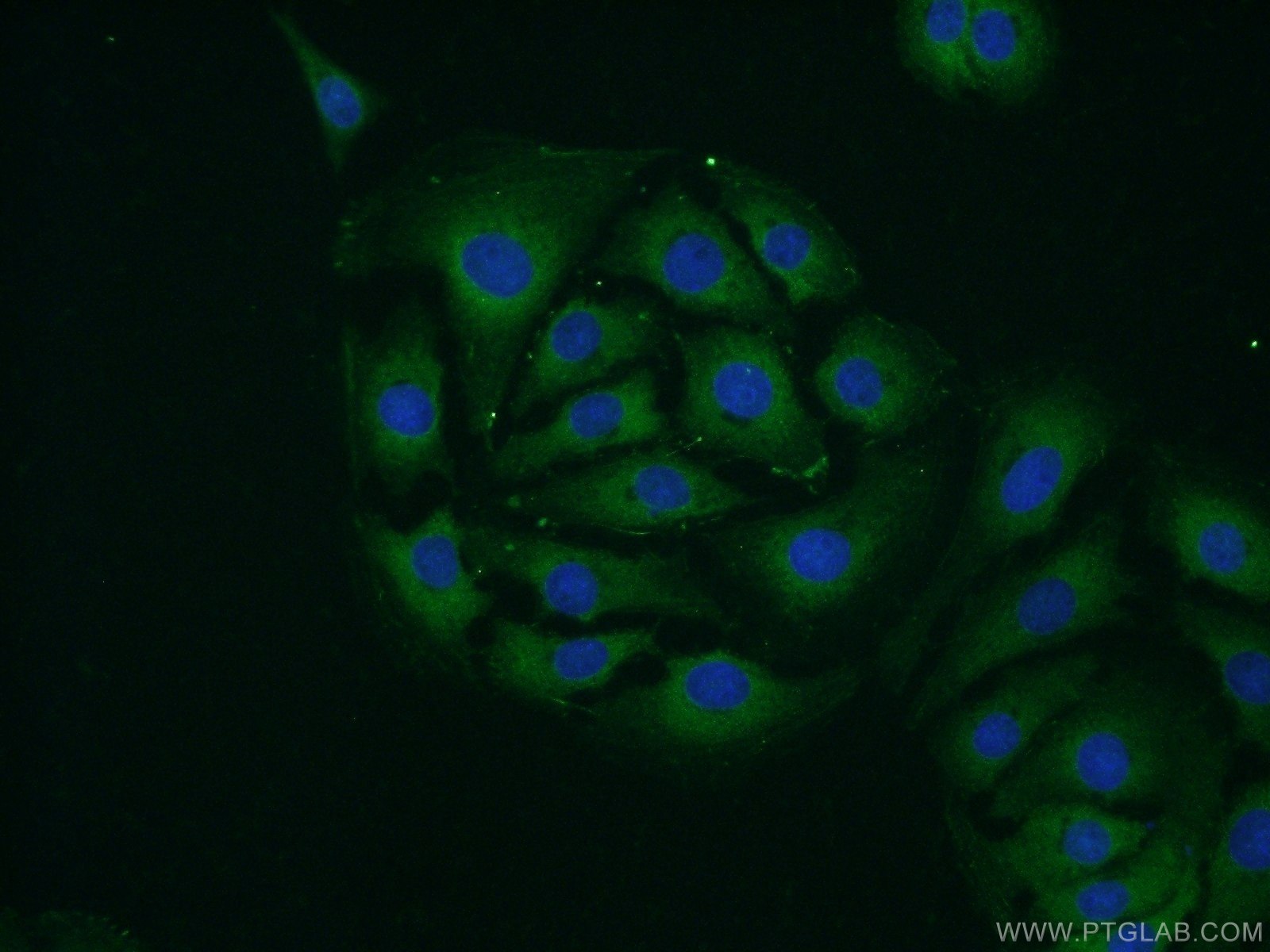 IF Staining of SH-SY5Y using 14831-1-AP