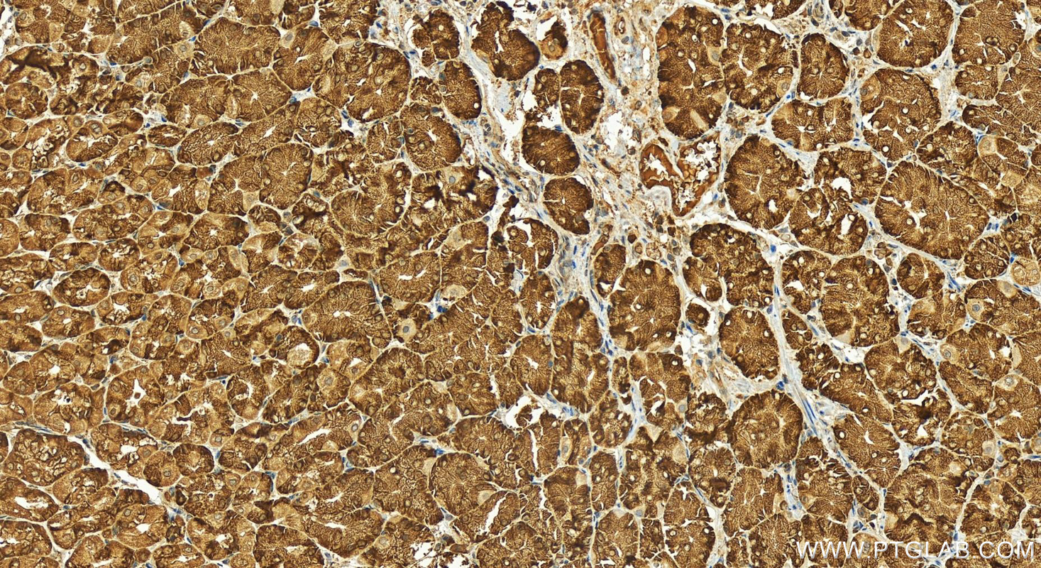 IHC staining of human stomach using 15871-1-AP