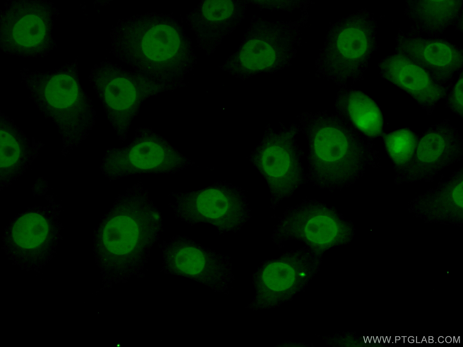 IF Staining of SH-SY5Y using 15871-1-AP