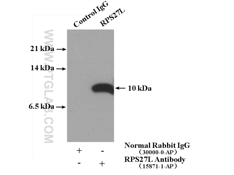 IP experiment of SH-SY5Y using 15871-1-AP