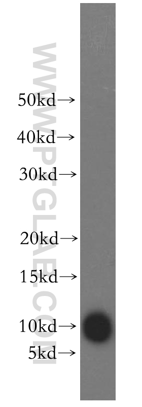 WB analysis of SH-SY5Y using 15871-1-AP