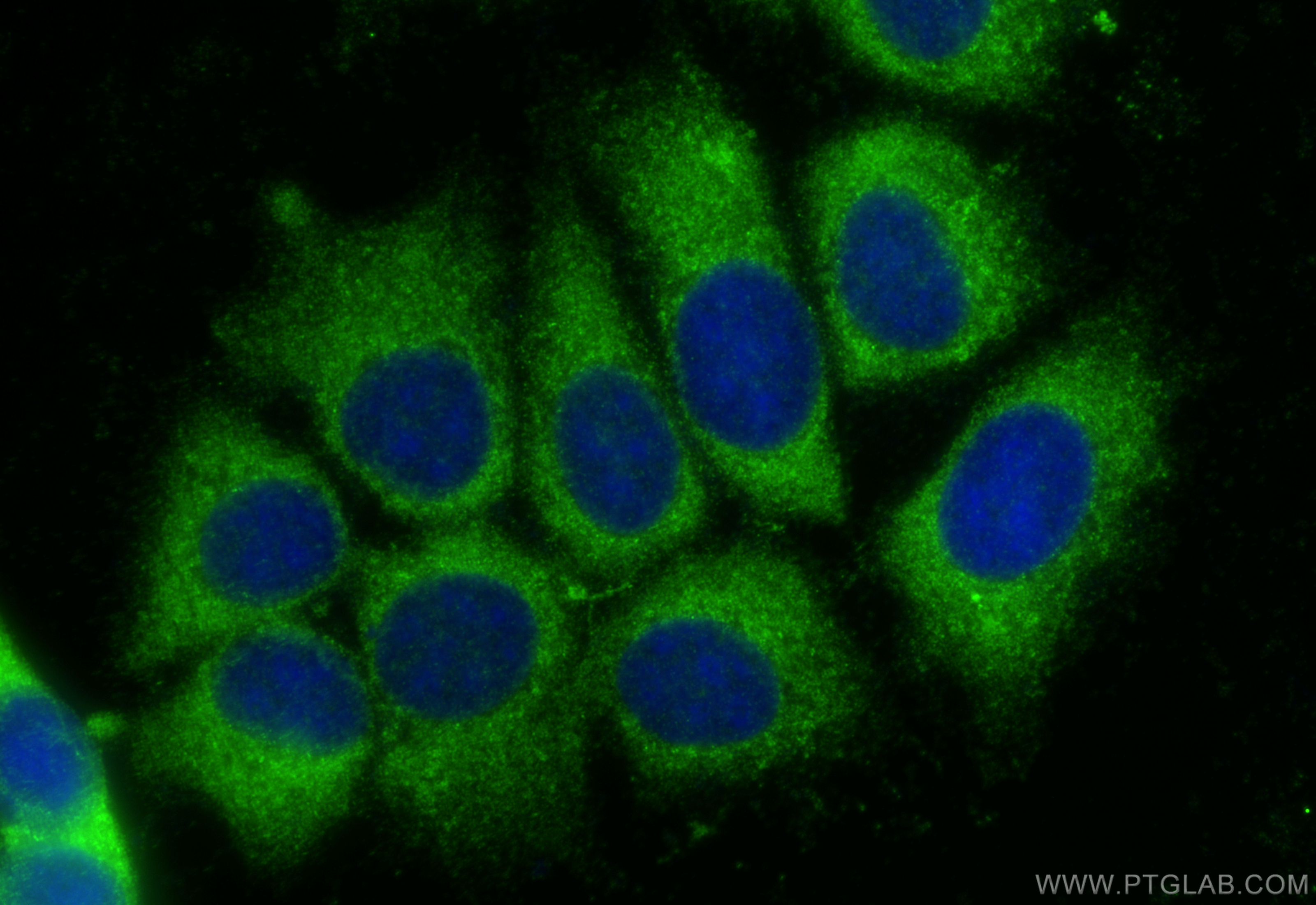 IF Staining of MCF-7 using 11990-1-AP