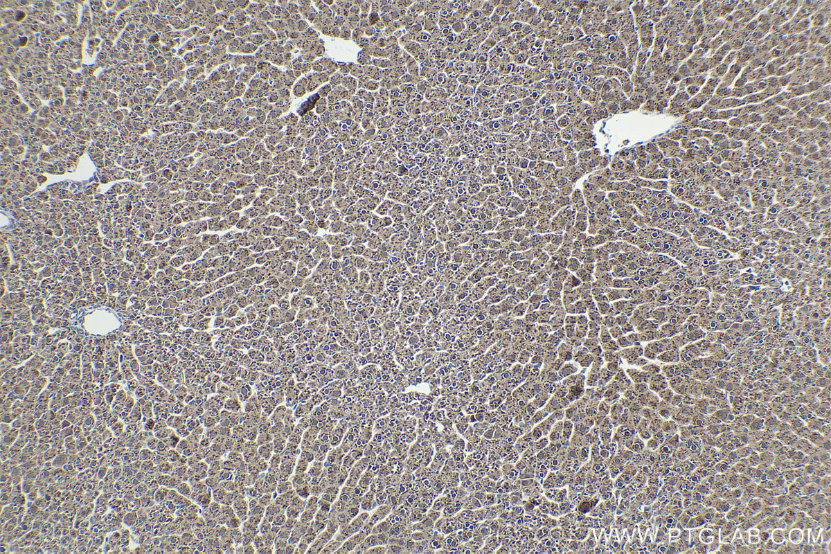 IHC staining of rat liver using 11990-1-AP