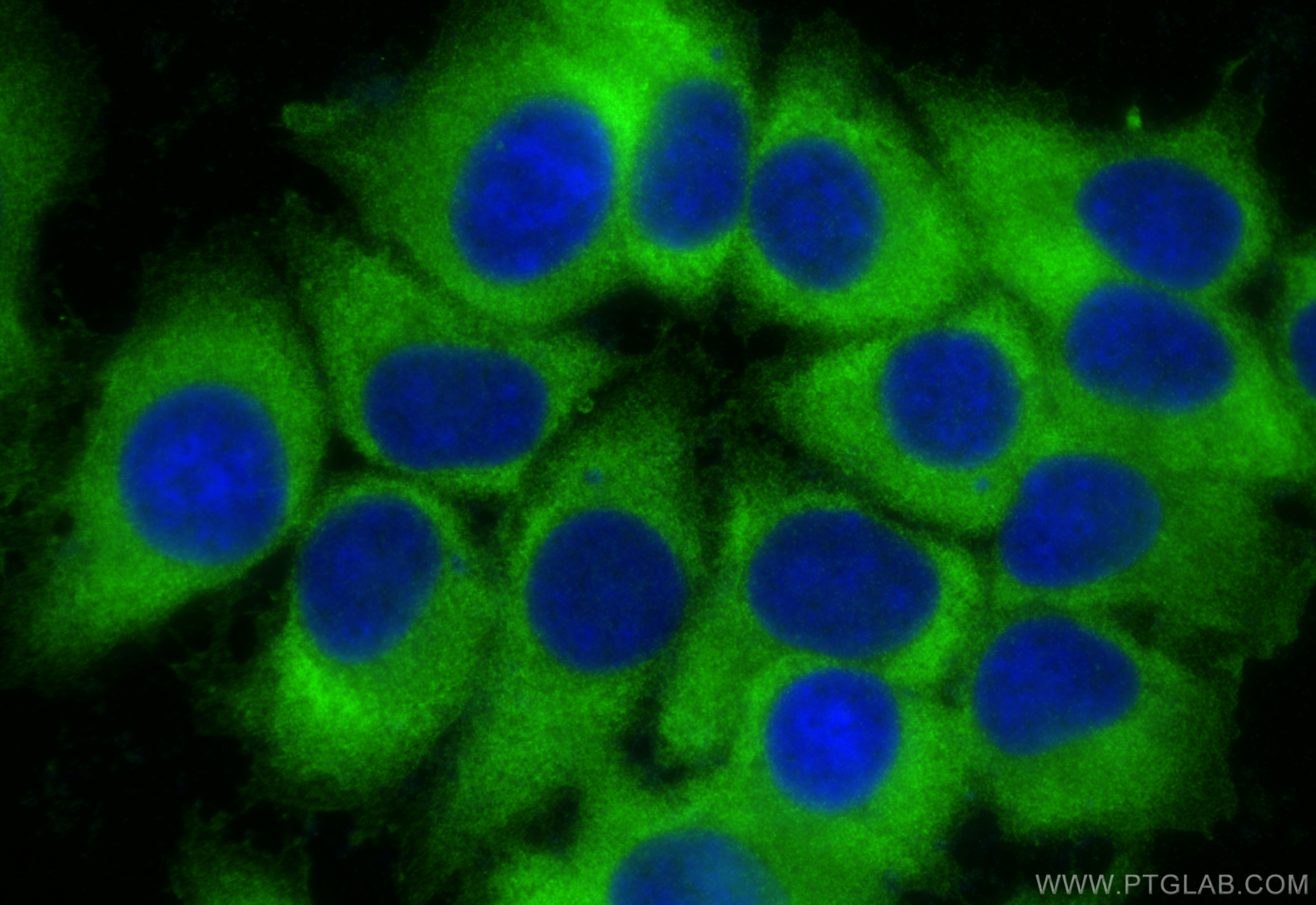 IF Staining of MCF-7 using 15198-1-AP