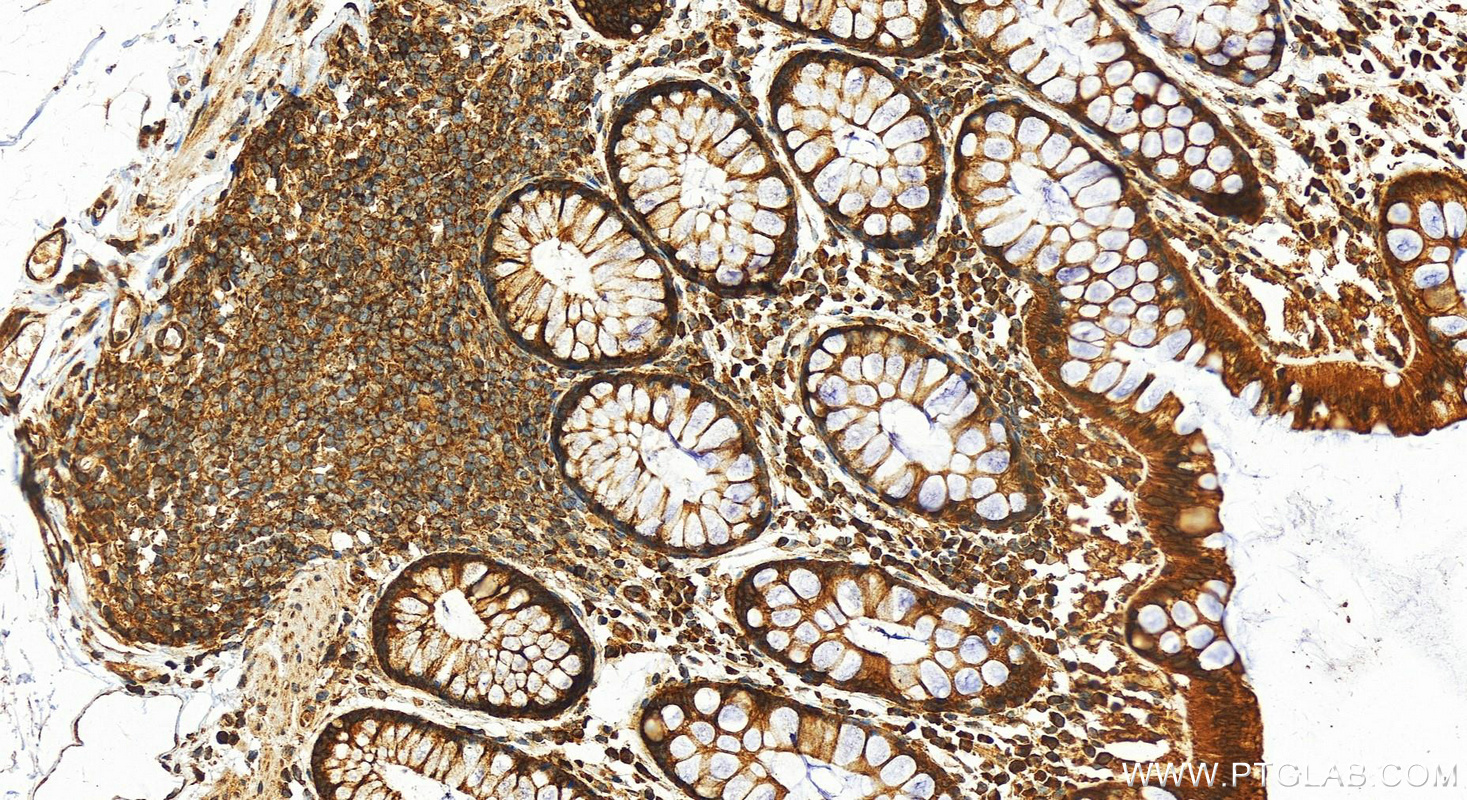 IHC staining of human colon using 14123-1-AP