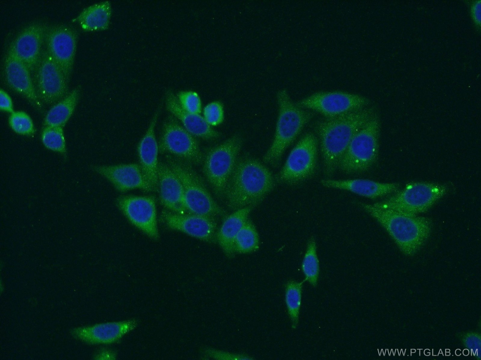 IF Staining of HepG2 using 16964-1-AP