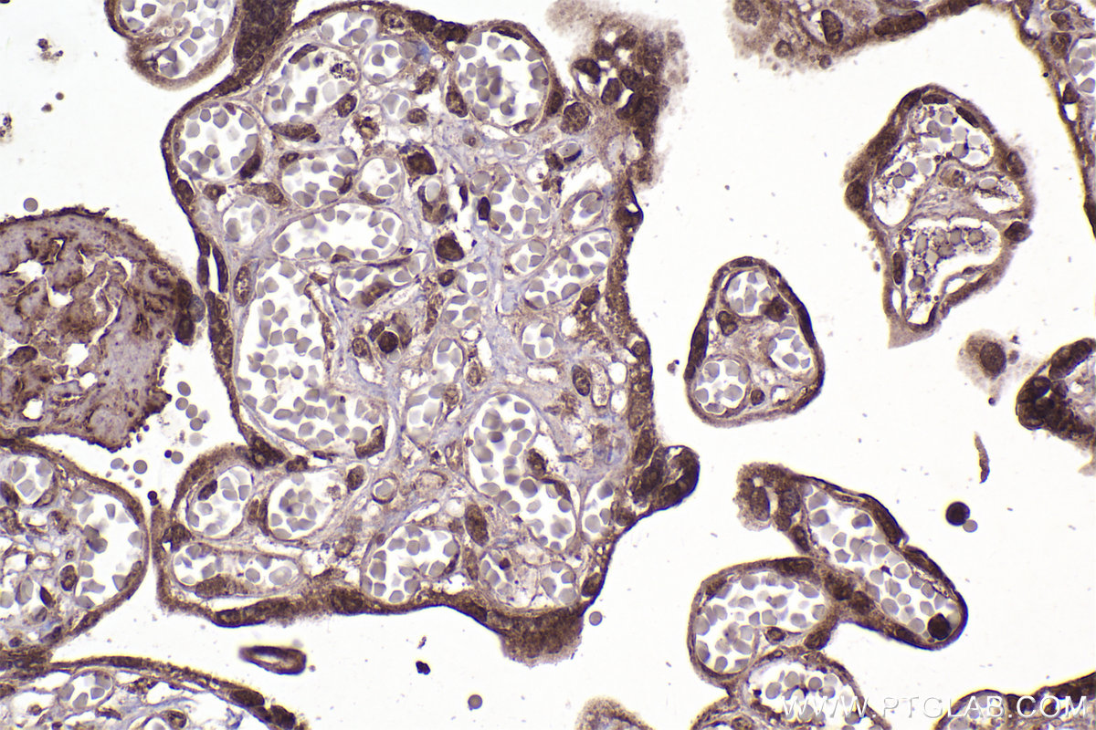 IHC staining of human placenta using 66886-1-Ig