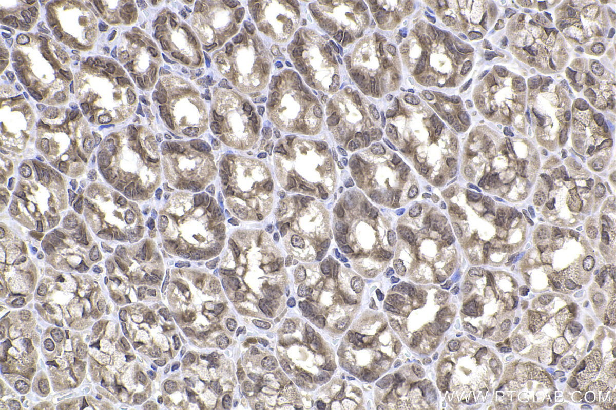 IHC staining of rat stomach using 66886-1-Ig (same clone as 66886-1-PBS)