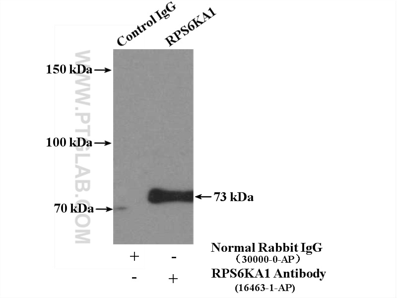 IP experiment of K-562 using 16463-1-AP