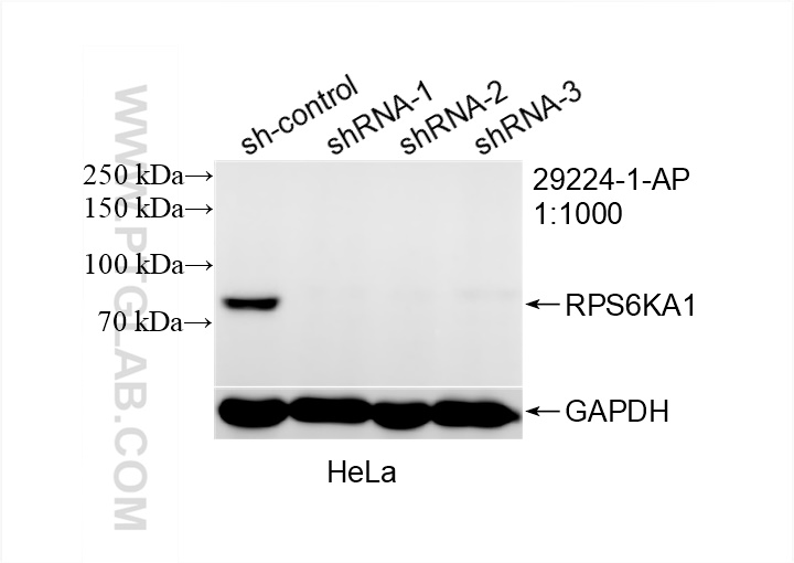 WB analysis of HeLa using 29224-1-AP