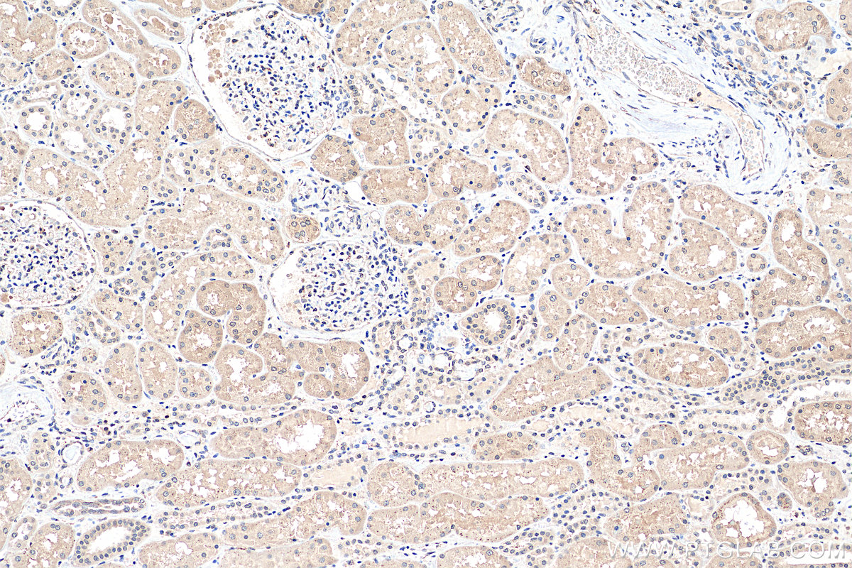 IHC staining of human kidney using 23762-1-AP