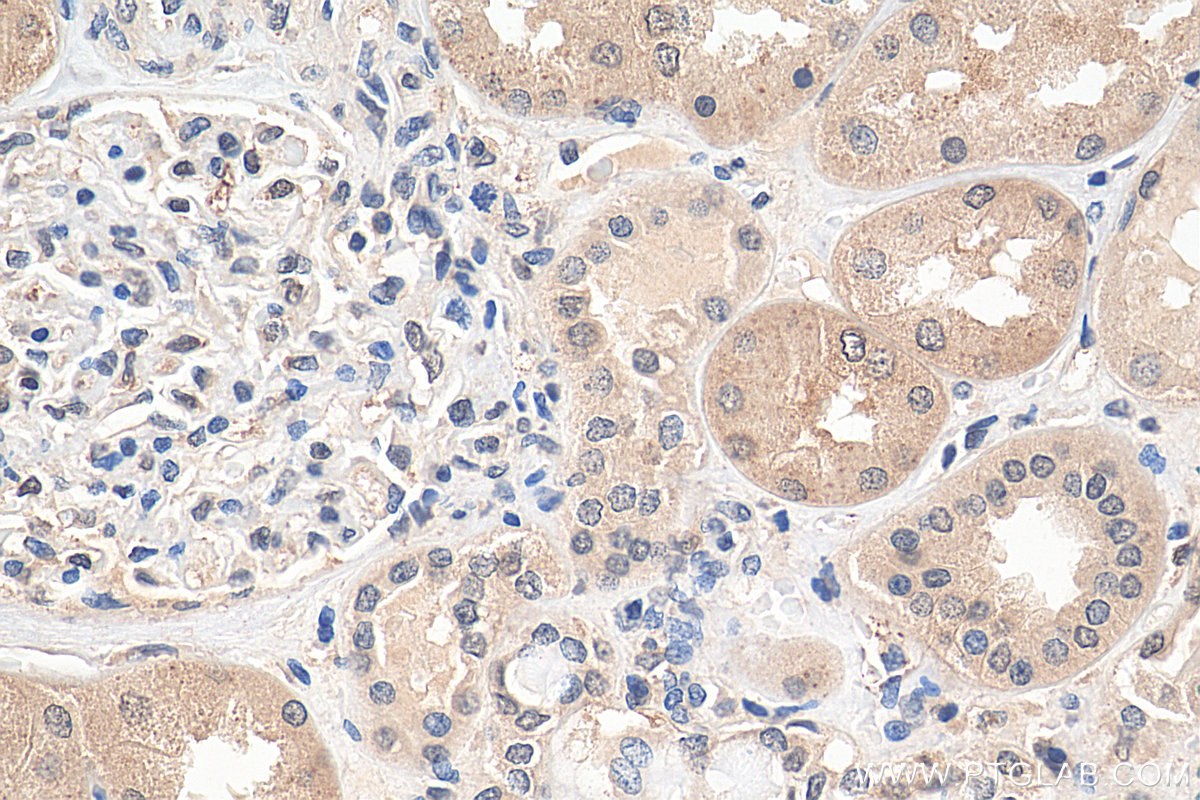 IHC staining of human kidney using 23762-1-AP