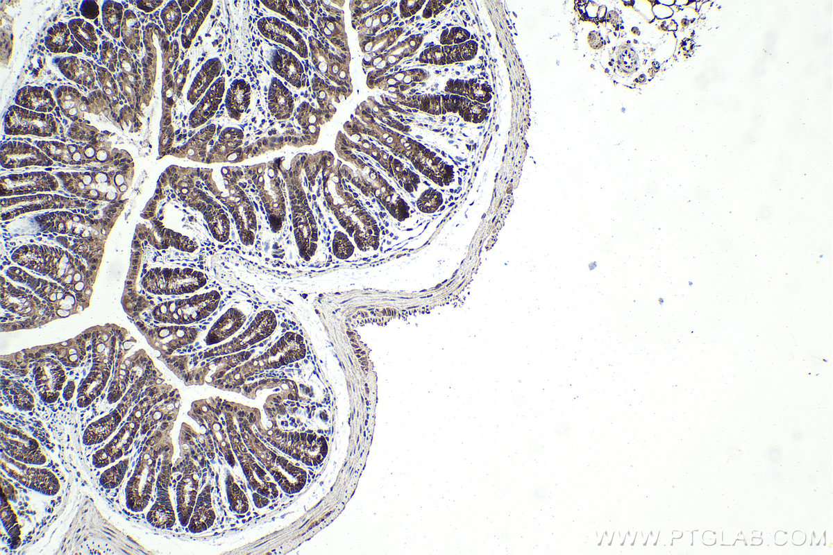 IHC staining of mouse colon using 23762-1-AP