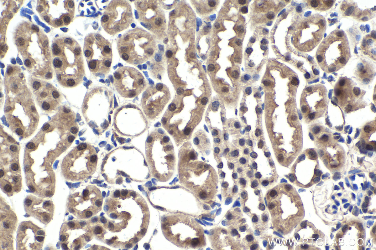 IHC staining of mouse kidney using 23762-1-AP