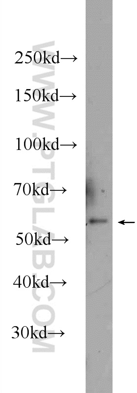 WB analysis of CHO using 24757-1-AP