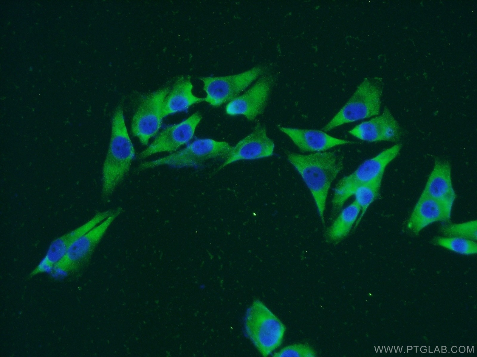 IF Staining of A375 using 18228-1-AP