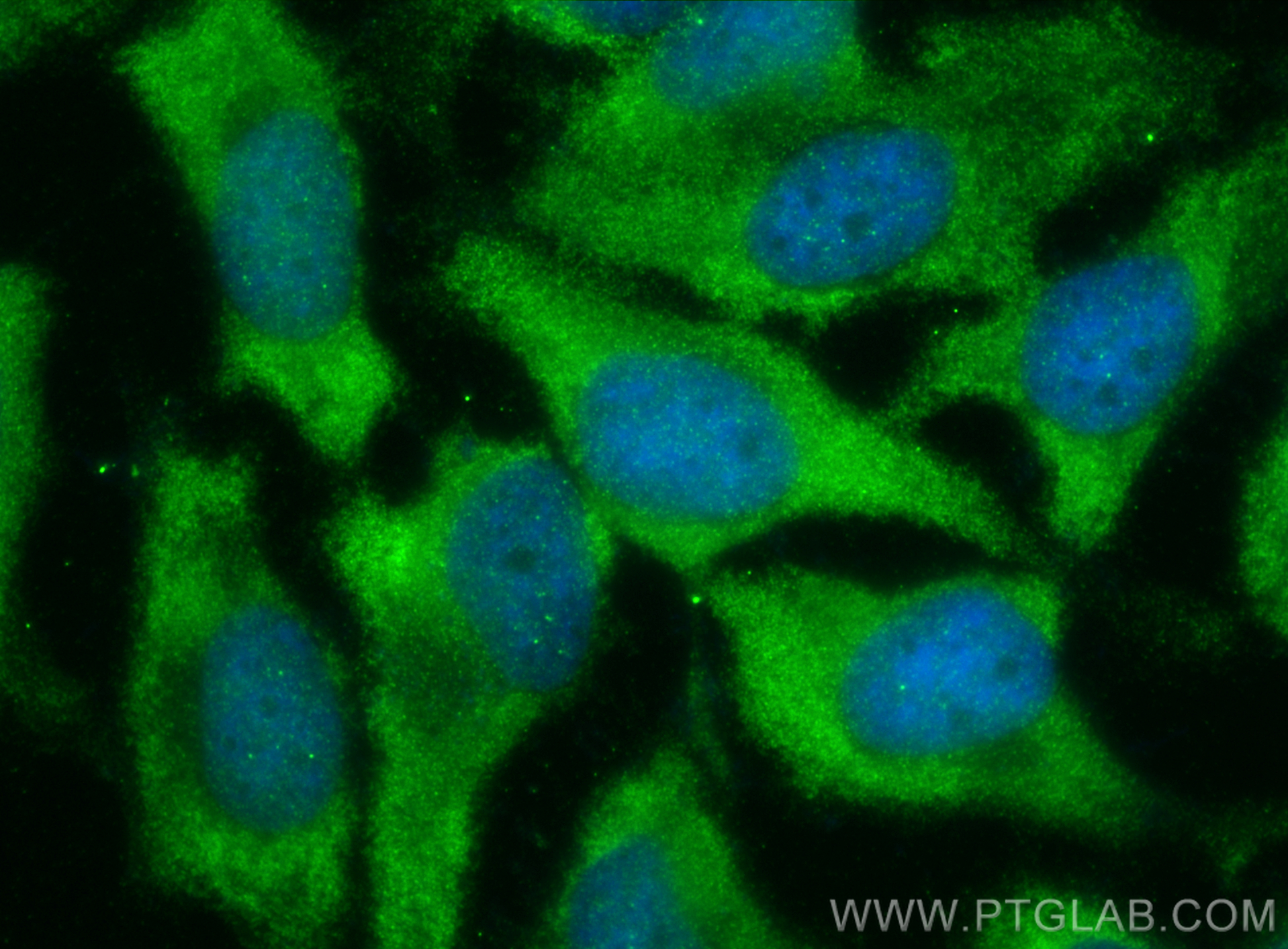 IF Staining of HeLa using 18215-1-AP