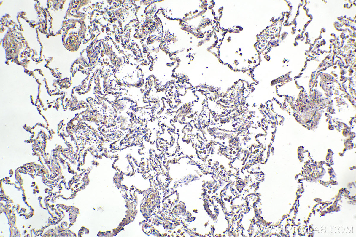 IHC staining of human lung using 18215-1-AP