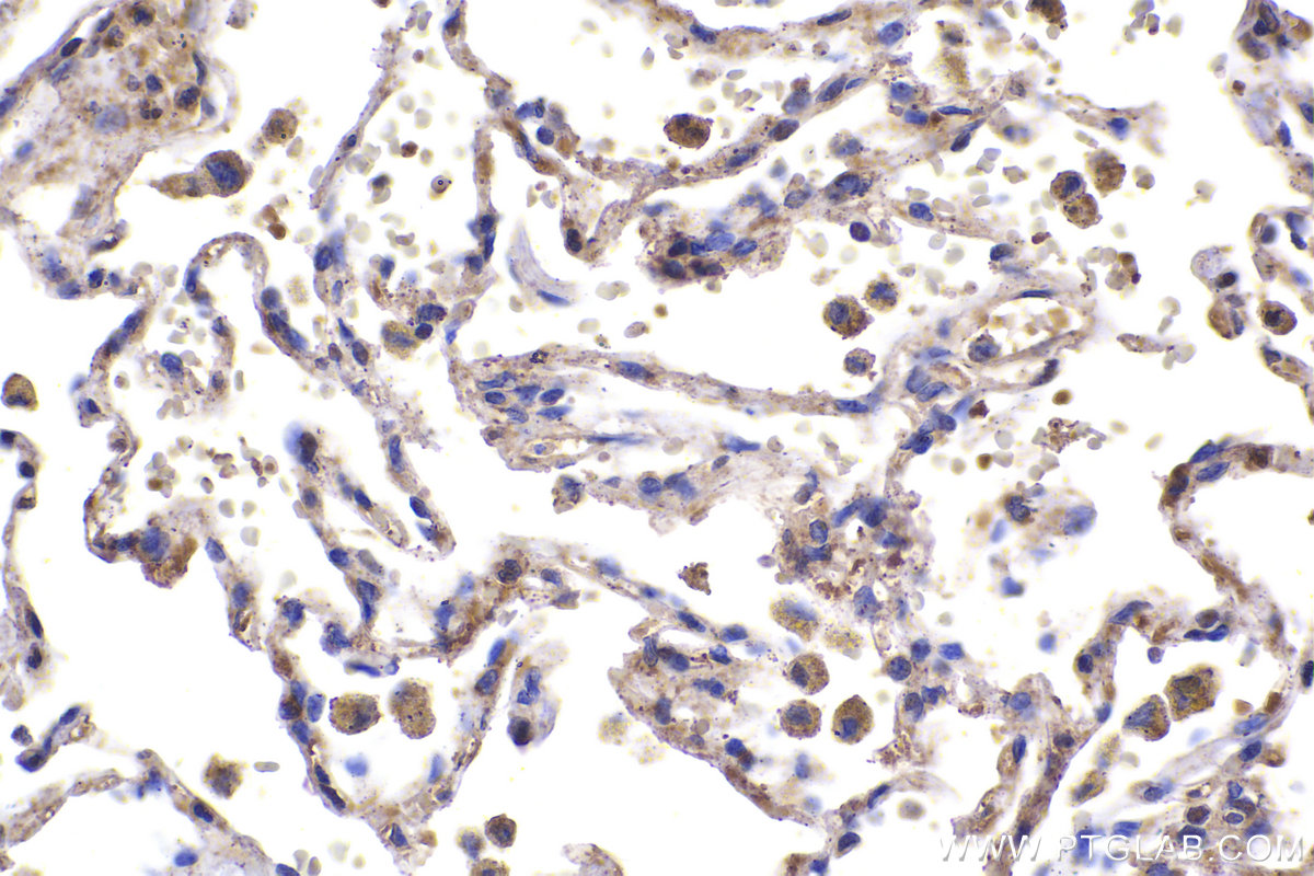 IHC staining of human lung using 18215-1-AP