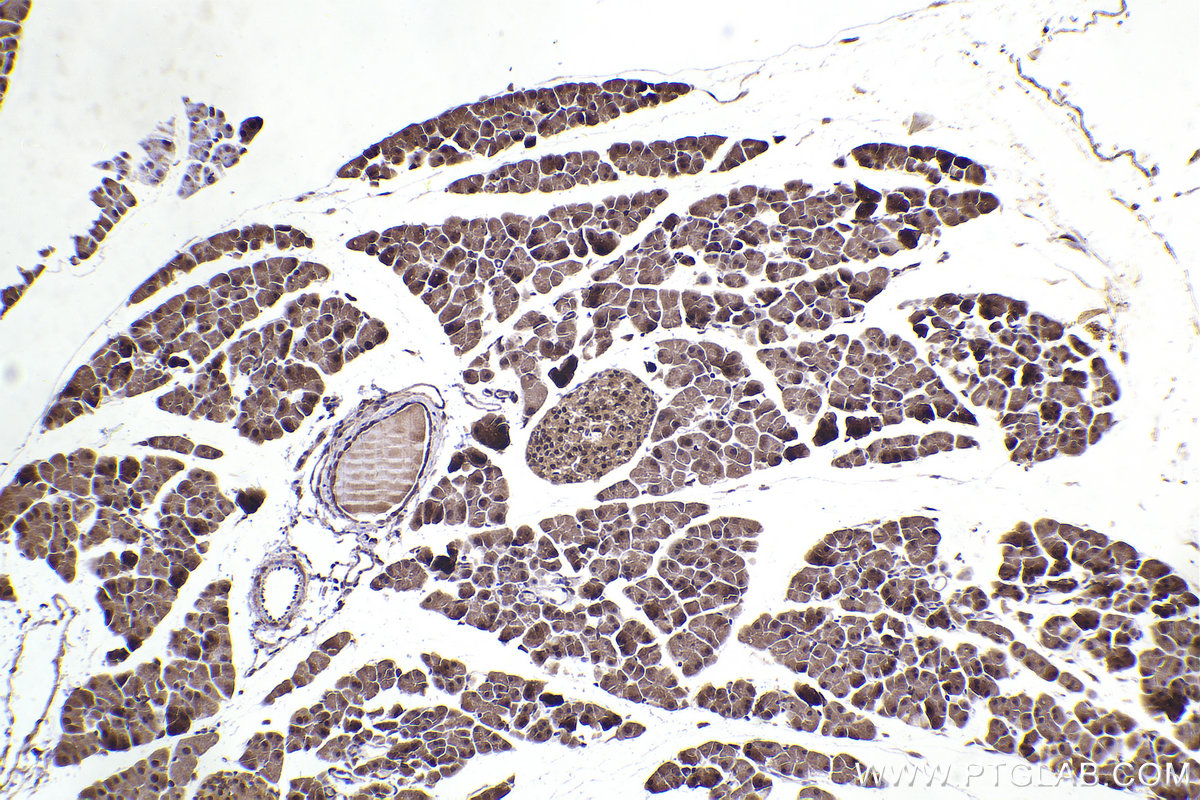 IHC staining of mouse pancreas using 18215-1-AP