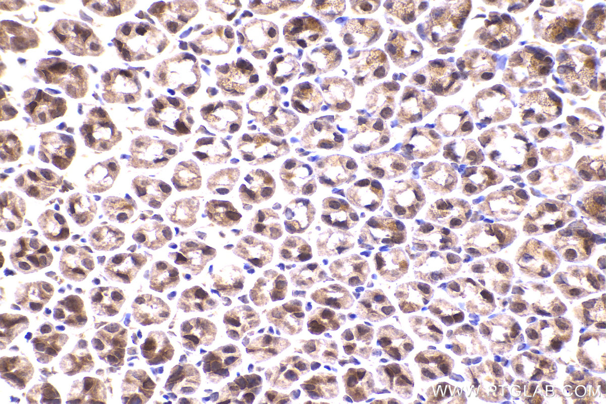 IHC staining of mouse stomach using 18215-1-AP