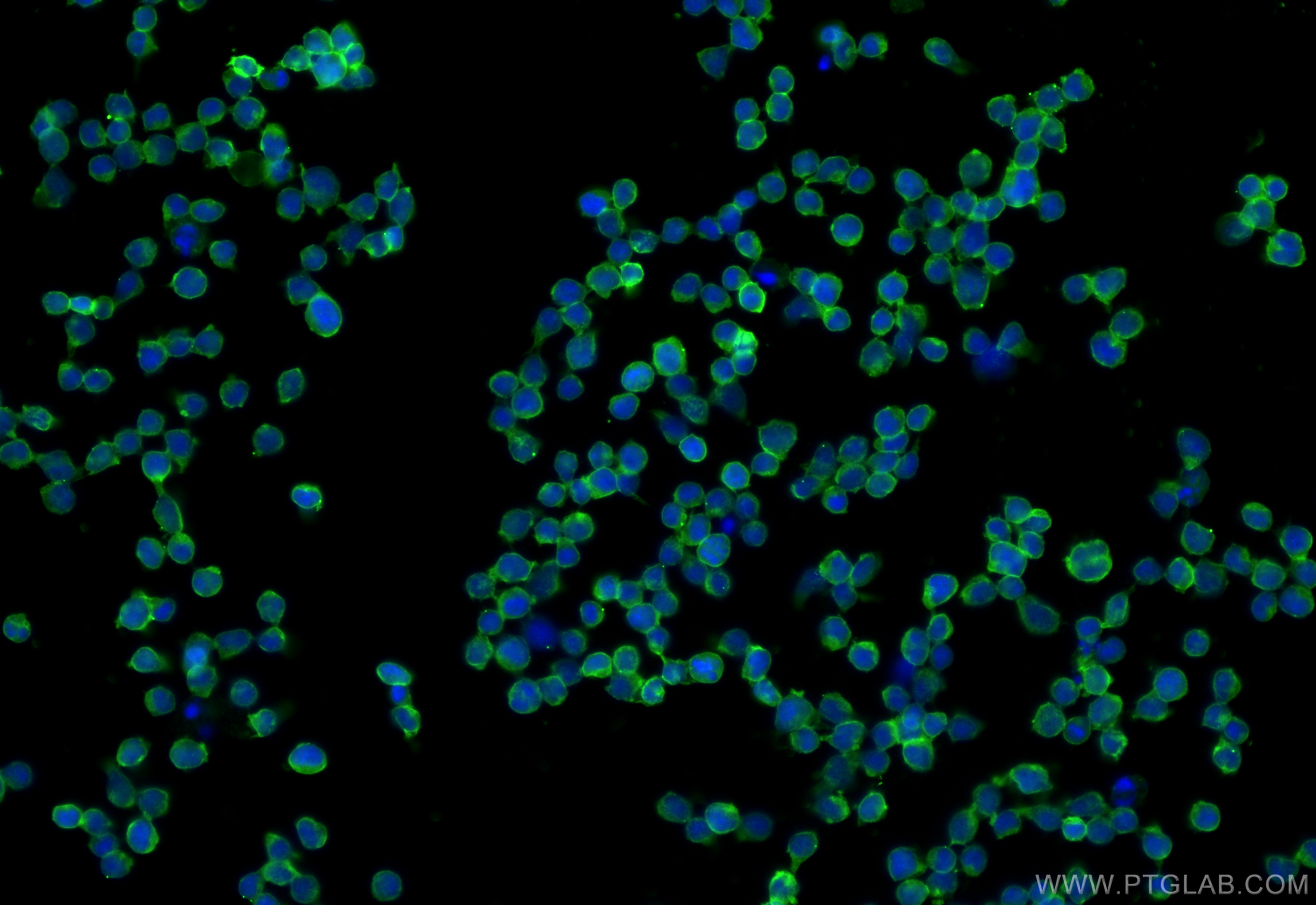 IF Staining of Jurkat using 20103-1-AP