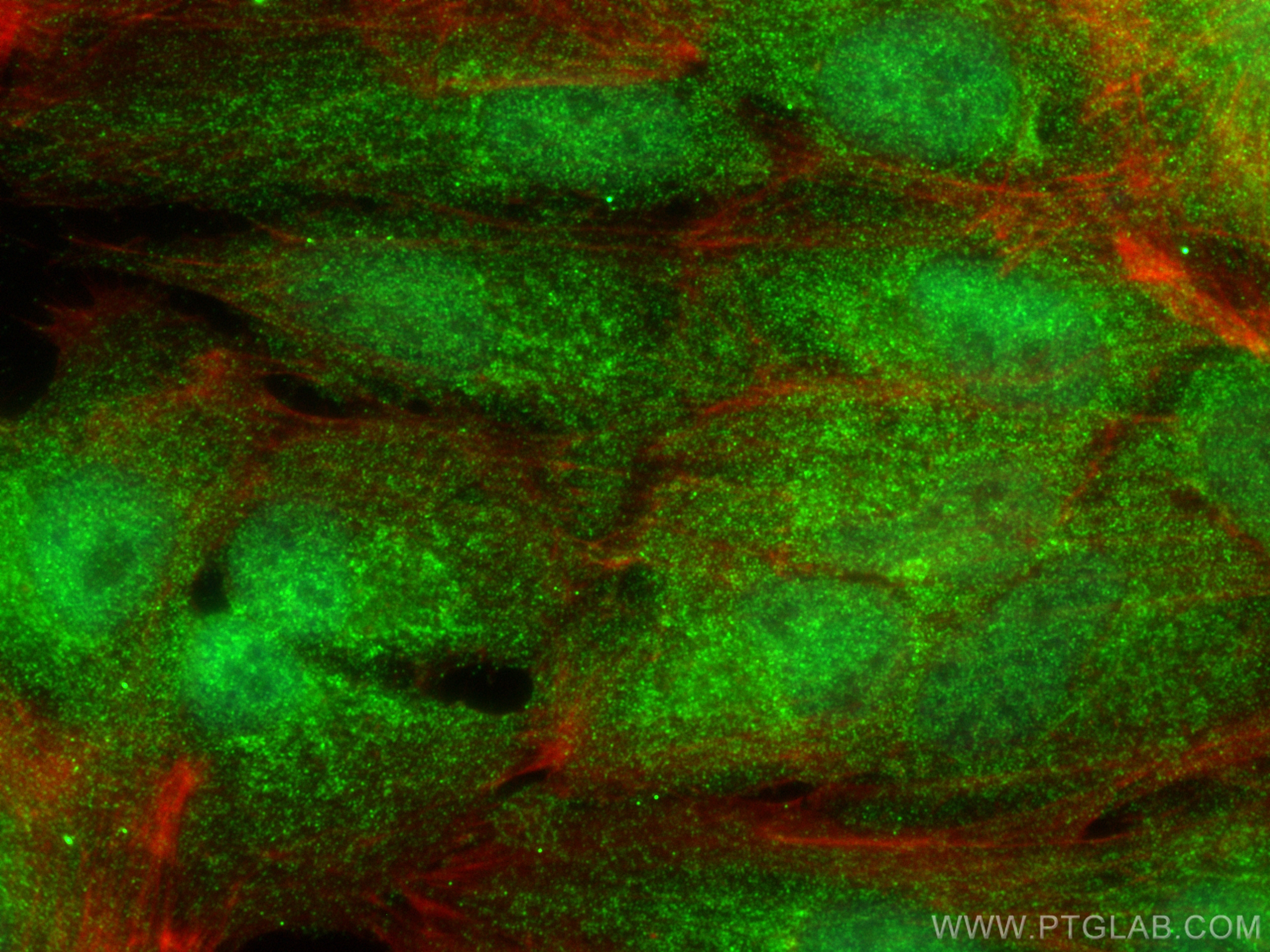 IF Staining of hTERT-RPE1 using 22503-1-AP