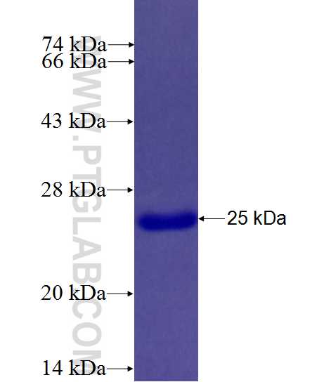 RRAD fusion protein Ag26880 SDS-PAGE