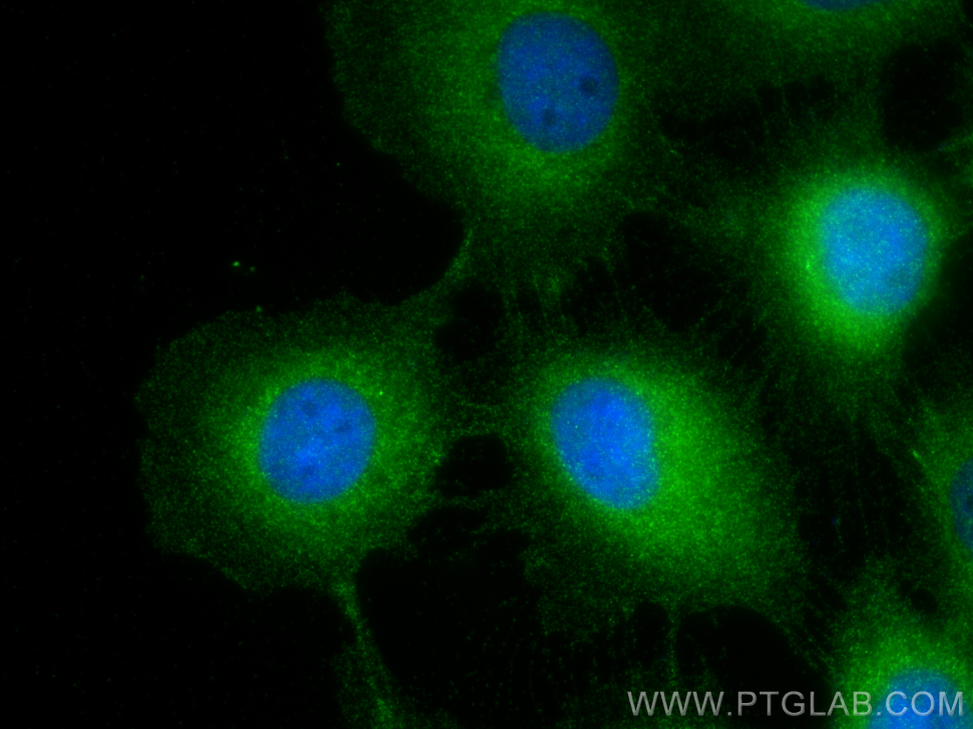 IF Staining of A431 using 12530-1-AP