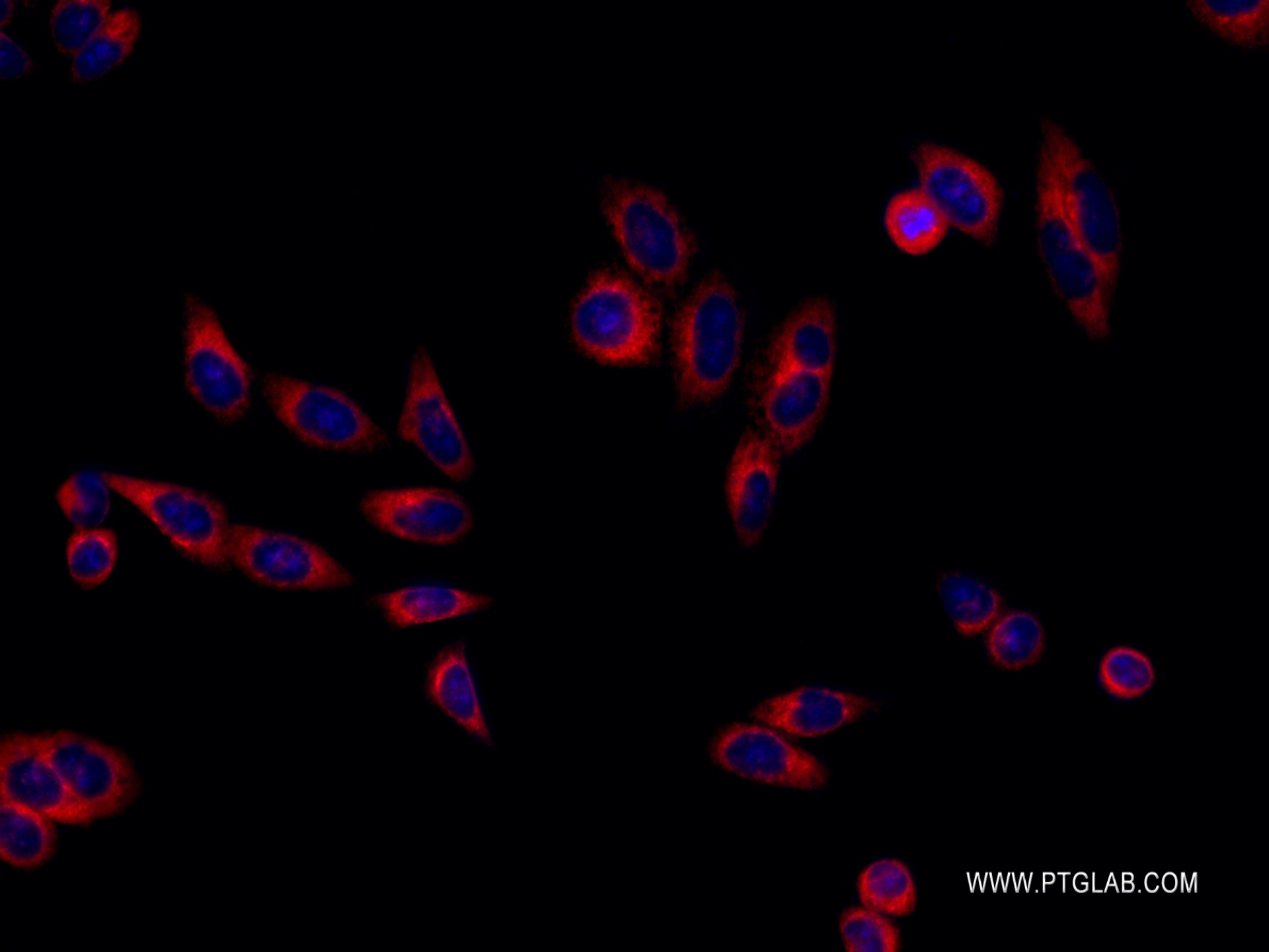 IF Staining of HepG2 using 82890-2-RR (same clone as 82890-2-PBS)