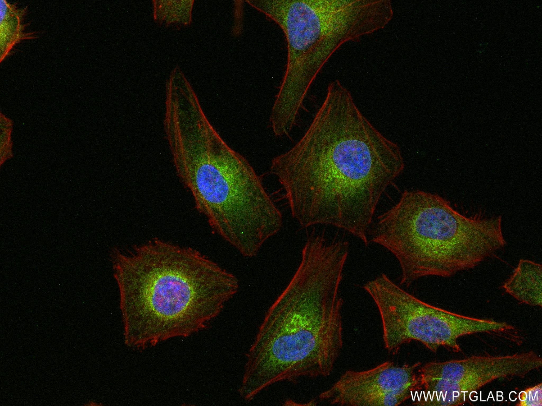 IF Staining of HeLa using 82890-3-RR (same clone as 82890-3-PBS)