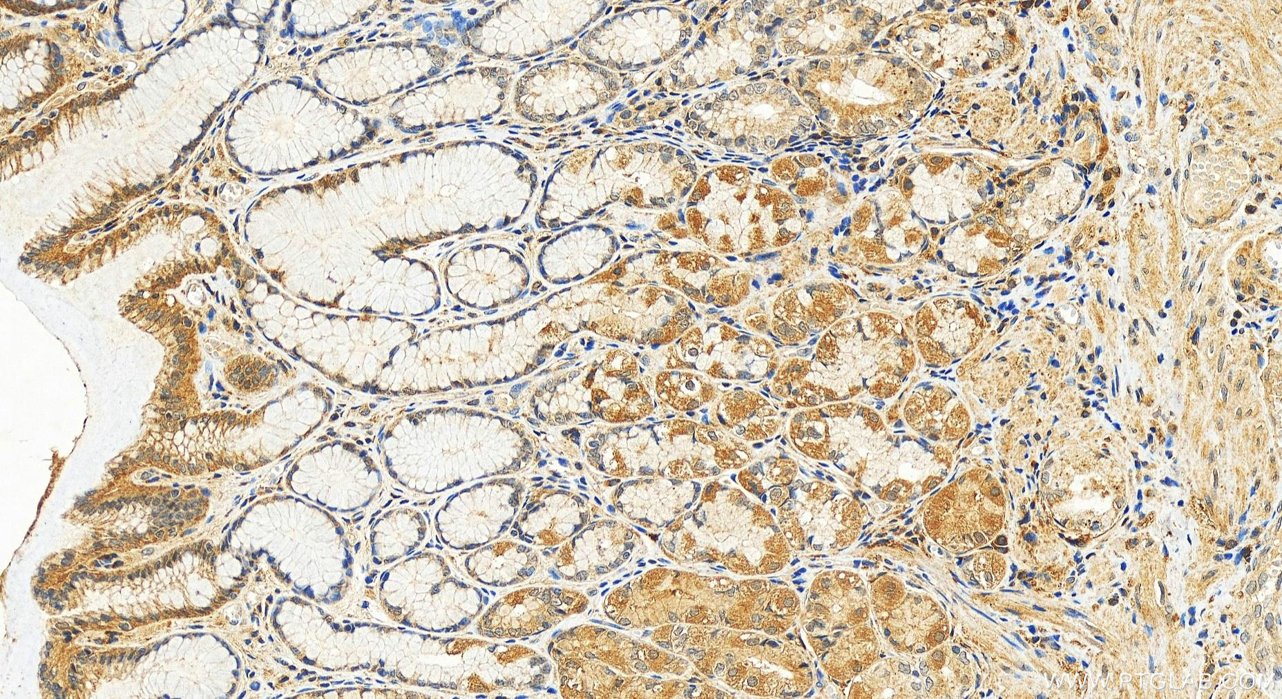 IHC staining of human stomach using 20280-1-AP