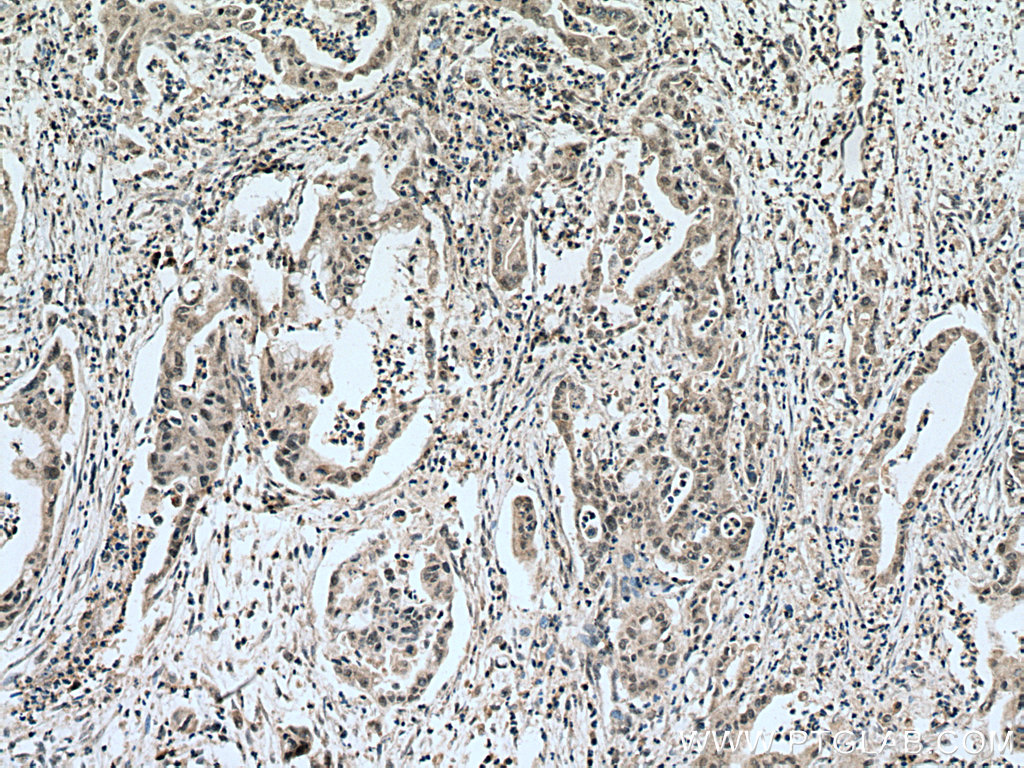 RREB1-Specific