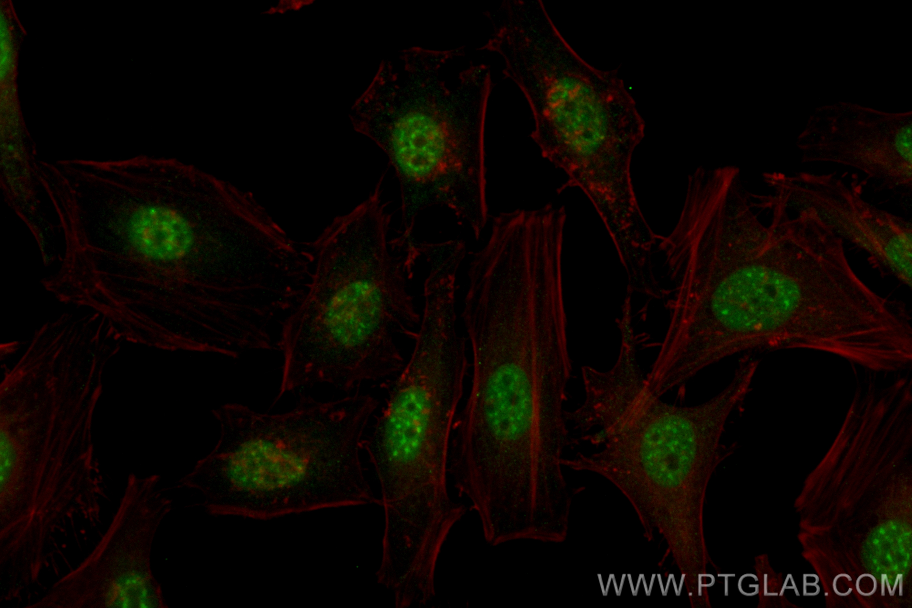 RREB1-Specific