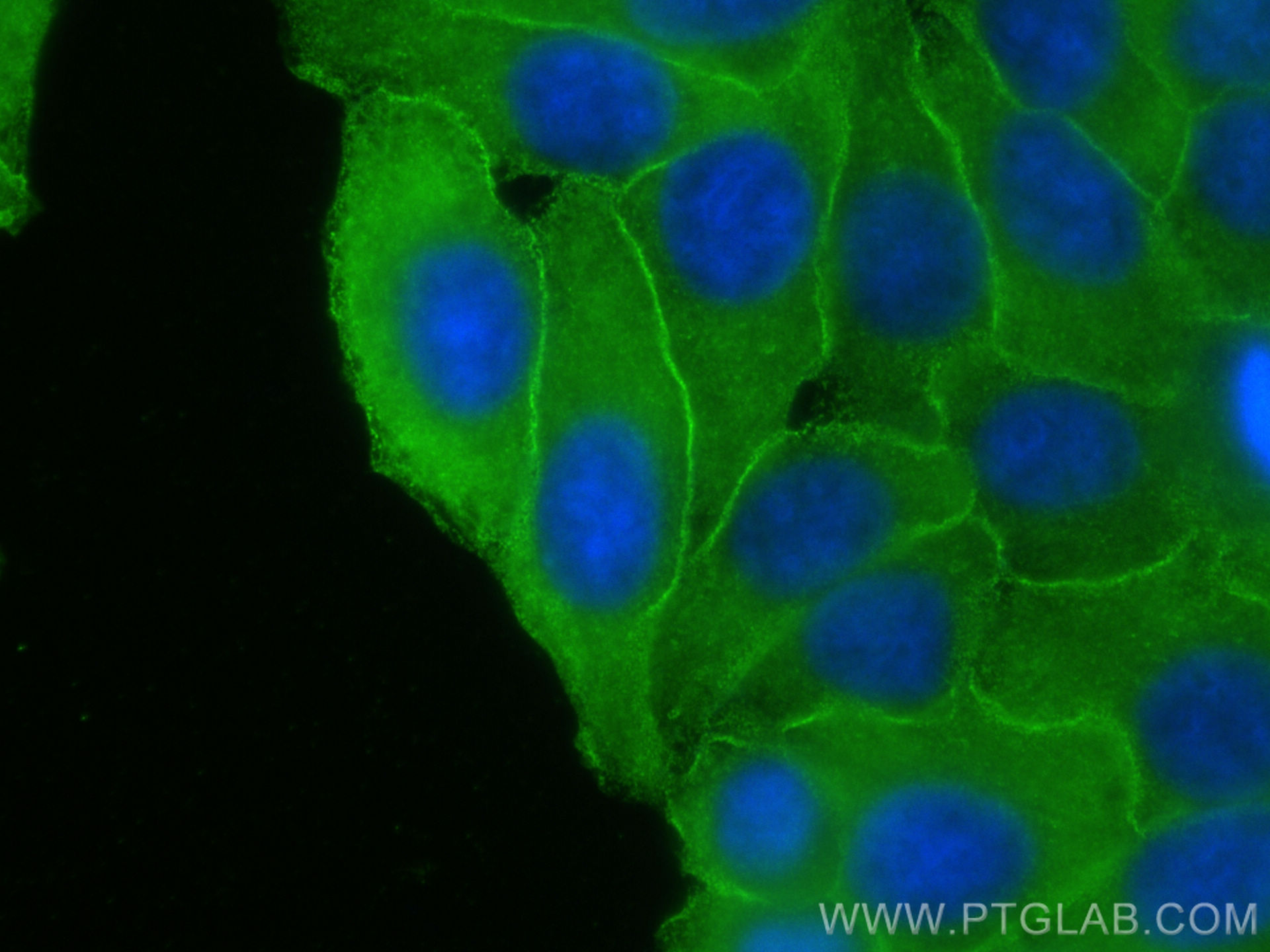 IF Staining of HepG2 using 67006-1-Ig (same clone as 67006-1-PBS)