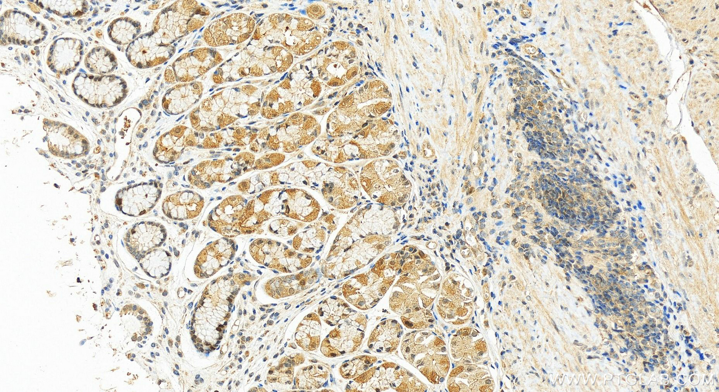 IHC staining of human stomach using 18005-1-AP