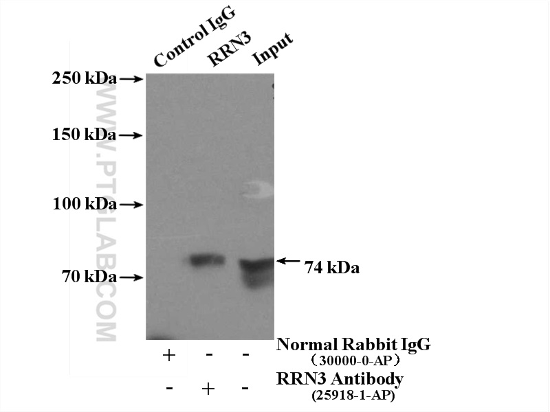 IP experiment of HeLa using 25918-1-AP