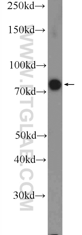 WB analysis of HeLa using 25918-1-AP