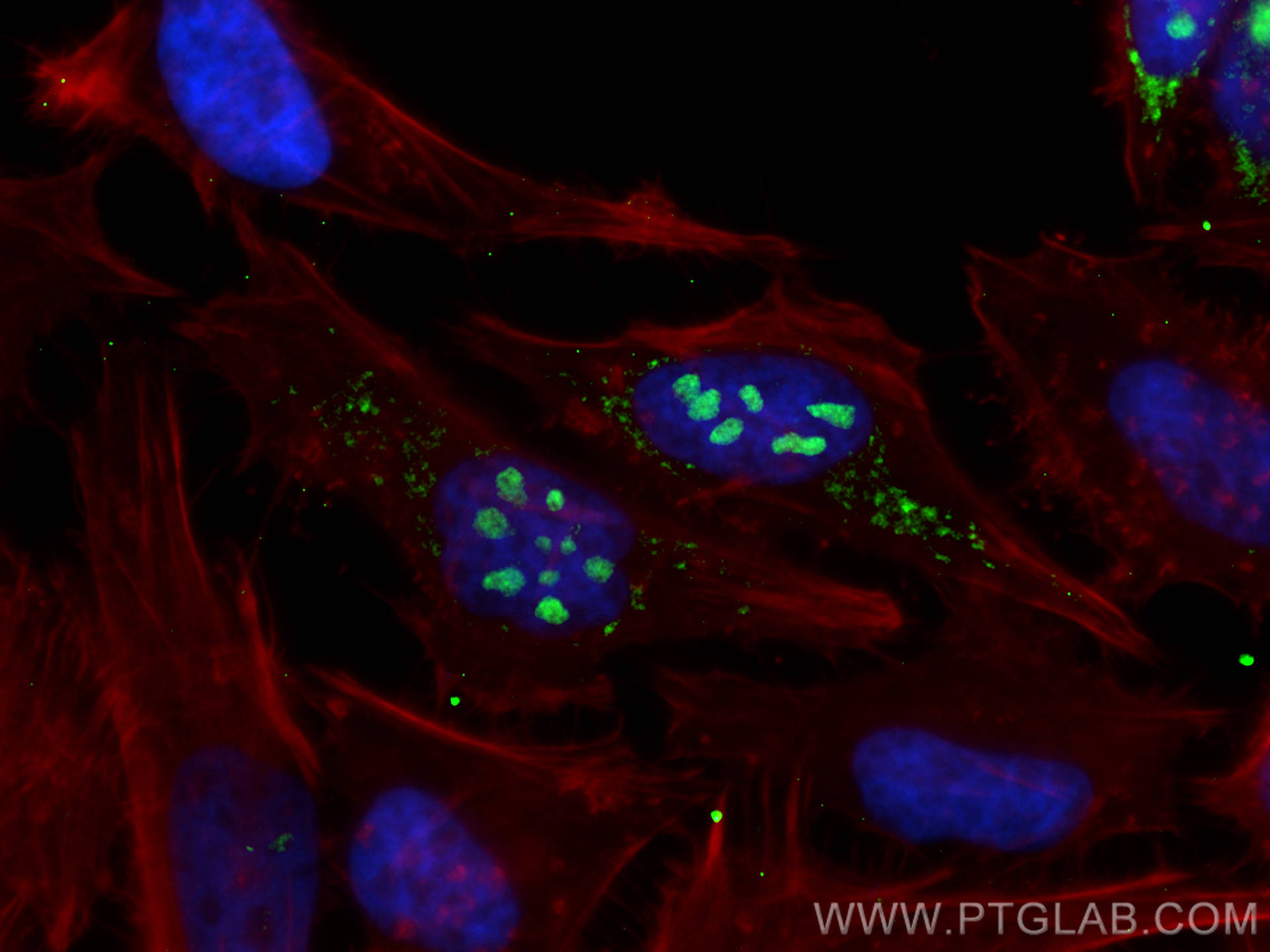 IF Staining of HeLa using 26849-1-AP