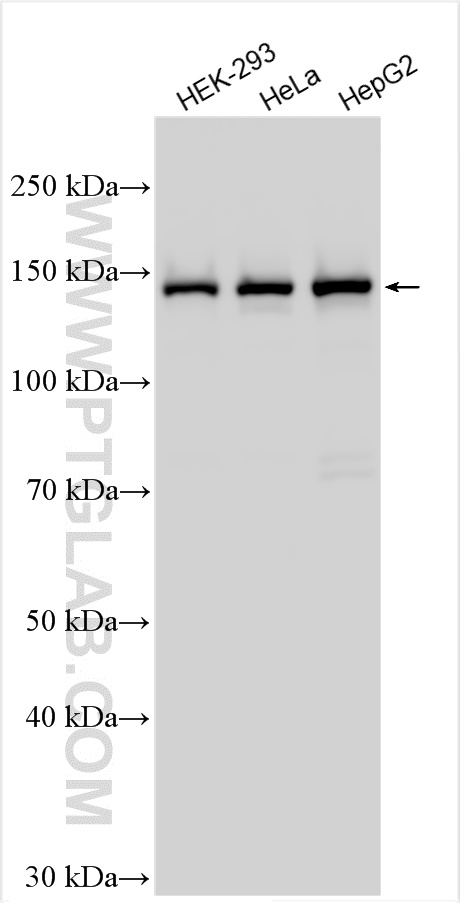 WB analysis using 26849-1-AP