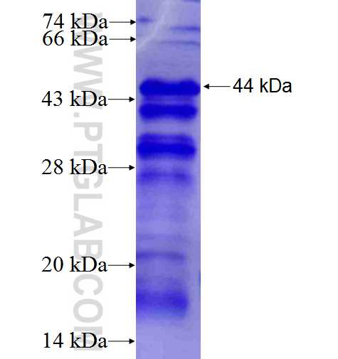 RRP1B fusion protein Ag23405 SDS-PAGE