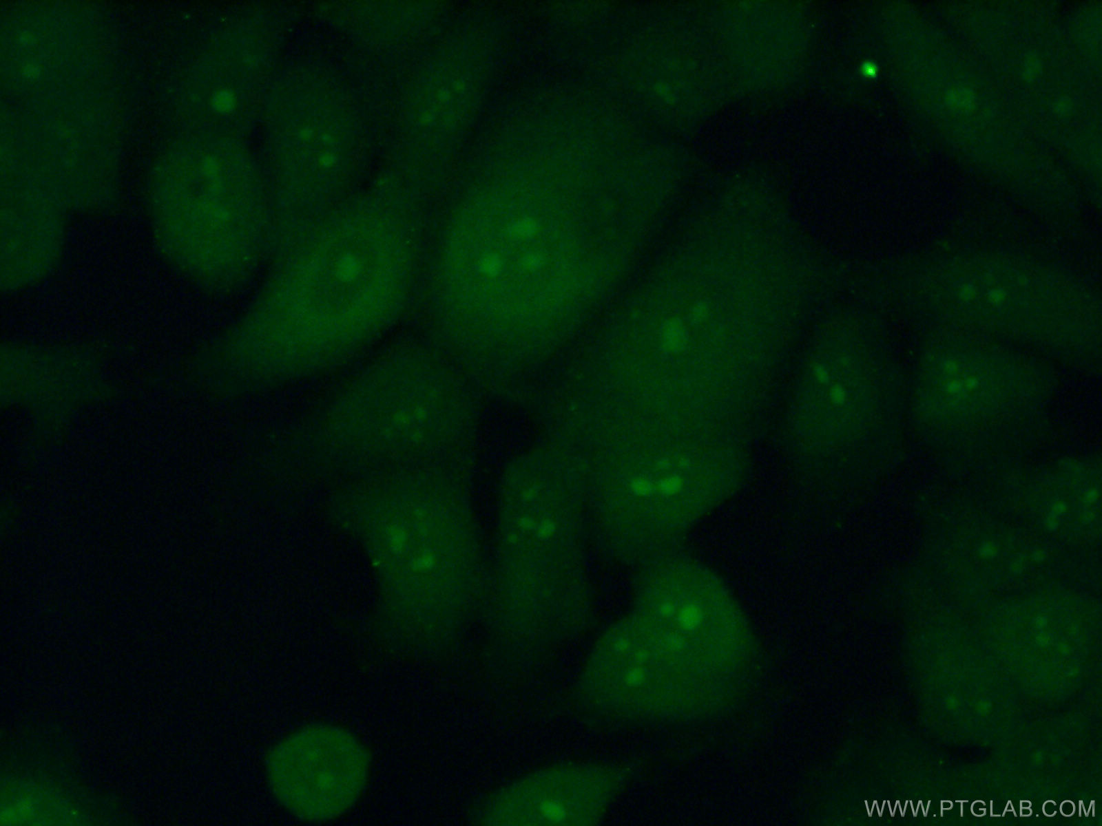 IF Staining of MCF-7 using 25440-1-AP