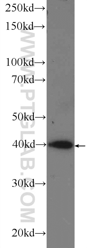 WB analysis of MCF-7 using 25440-1-AP