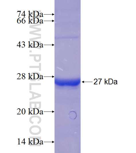 RRP7A fusion protein Ag21617 SDS-PAGE