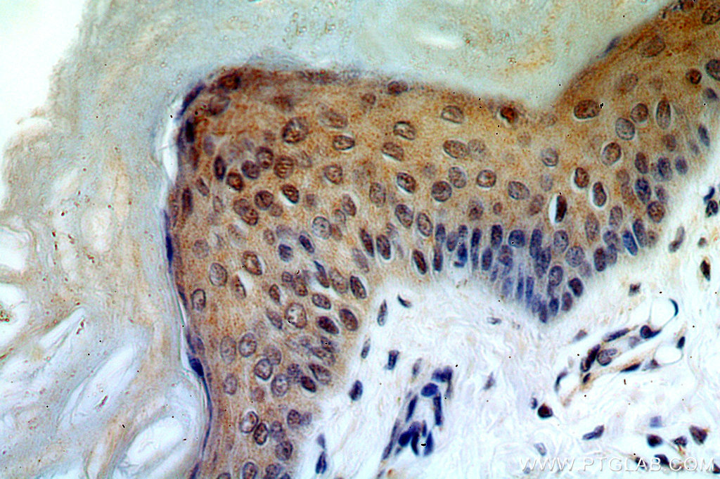 IHC staining of human skin using 20129-1-AP