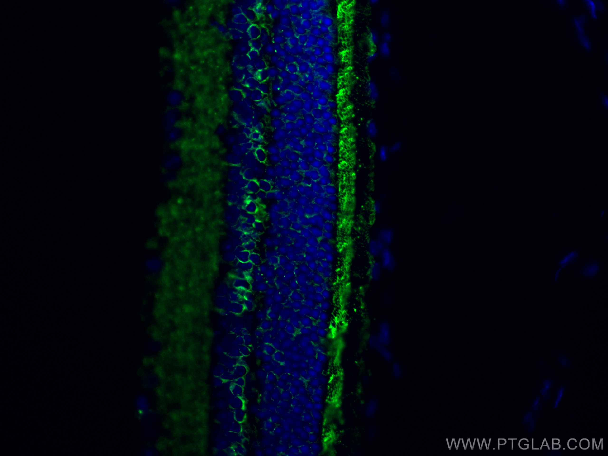 IF Staining of mouse eye using 24430-1-AP