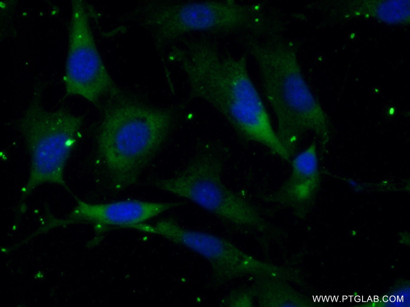 IF Staining of NIH/3T3 using 17603-1-AP